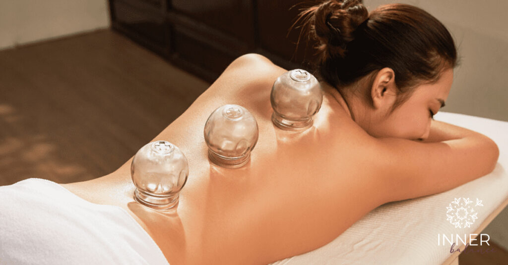Šta je to cupping i da li je bolan?